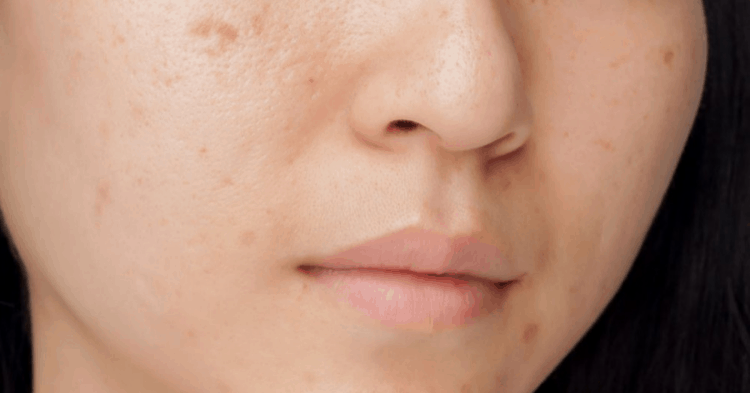 Are S’porean Online Dermatologists Reliable Enough To Be The New Future Of Skincare?